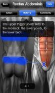 Trigger Points