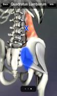 Trigger Points