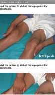 Clinical Examination